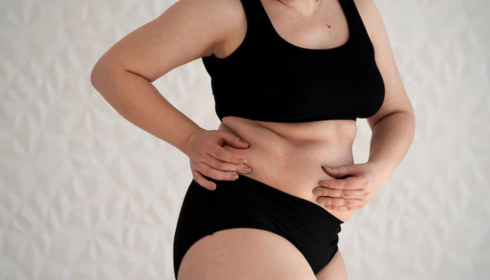 liposuction in bangalore